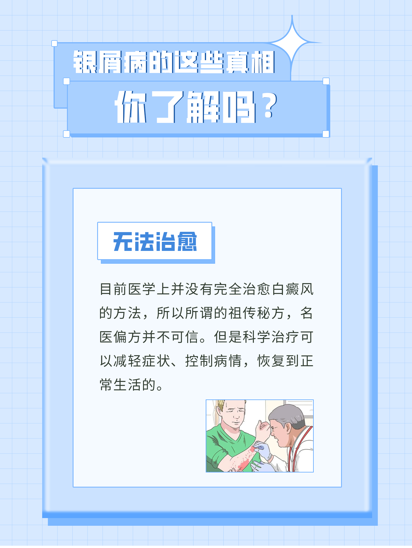 银屑病的这些真相，你了解吗？